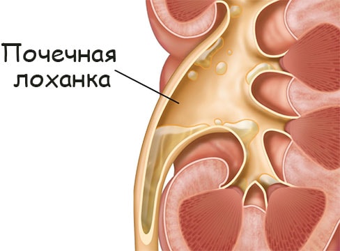 Что такое кракен шоп